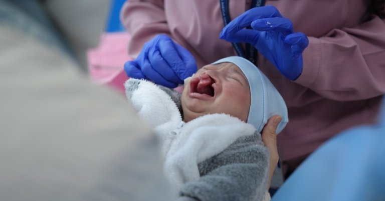 Dudak damağı yarığıyla dünyaya gelen bebek için tedaviye başlandı