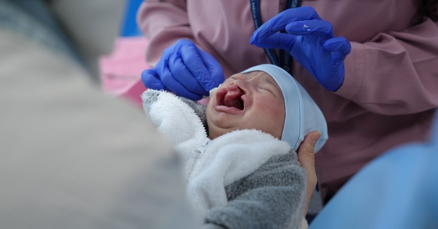 Dudak damağı yarığıyla dünyaya gelen bebek için tedaviye başlandı