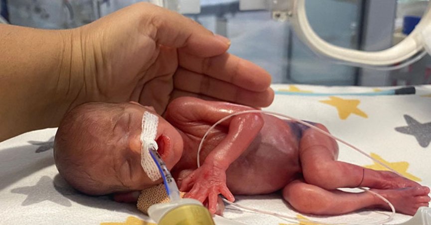380 gram doğan bebek hayata tutundu