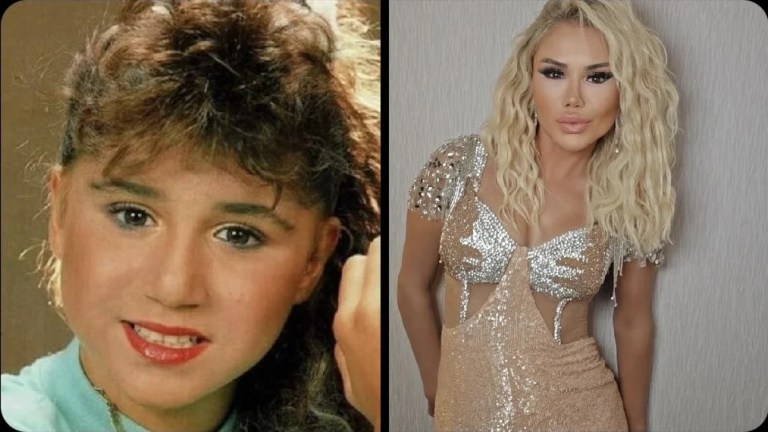 Şarkıcı Ceylan’dan estetik itirafı: Yüzüm artık kaldırmıyor