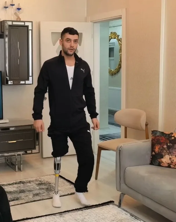 Akın İşik'in Hayata Dönüşü: Protezle Yeniden Yürüyor