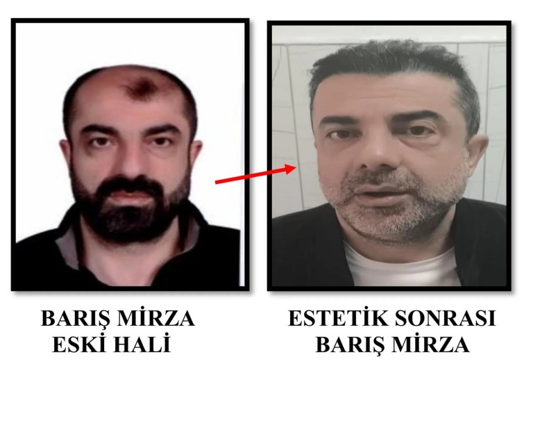 Firari Şüpheli Estetikle Yüzünü Değiştirip Yakalandı