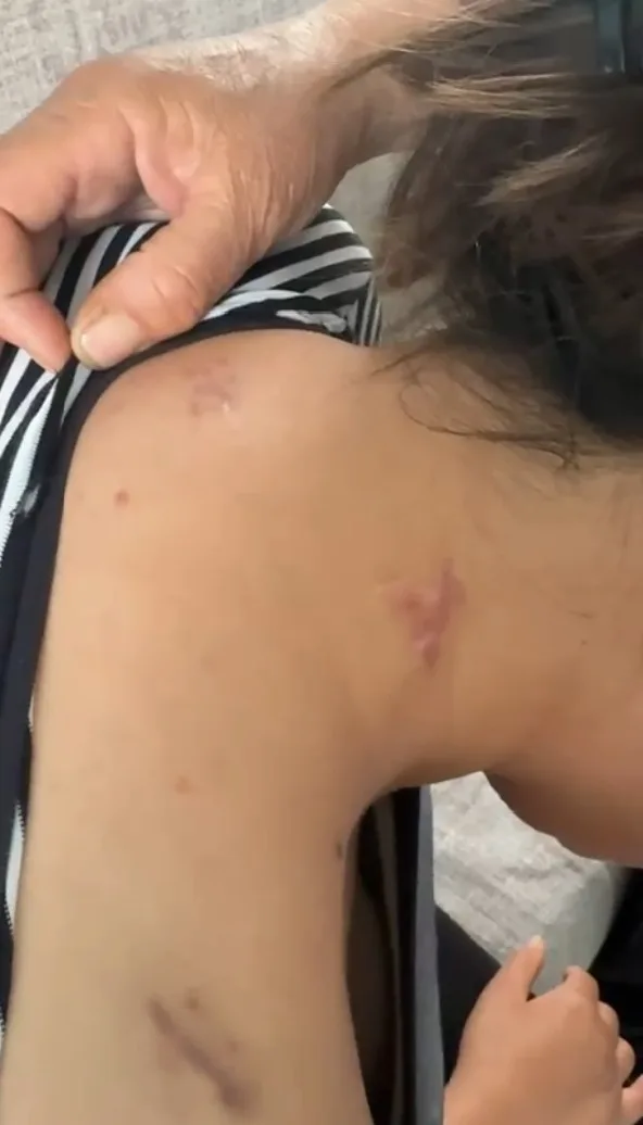 Eşi Tarafından Bıçaklanan Kadın Adalet İstiyor