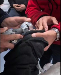 Amasya'da Parmağı Sıkışan Çocuğu İtfaiye Kurtardı