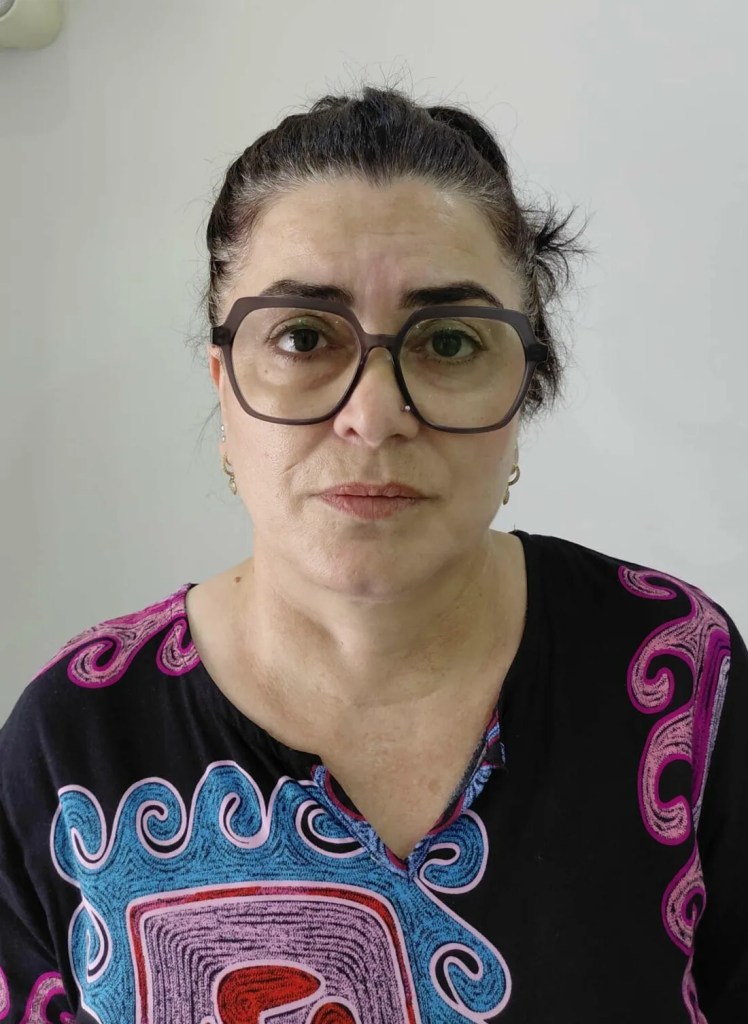 Kalça Dolgusu Sonrası Ölümde Hapis İstemi!